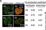 Mouse IgG (H+L) Highly Cross-Adsorbed Secondary Antibody in Immunocytochemistry (ICC/IF)