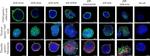 Rat IgG (H+L) Cross-Adsorbed Secondary Antibody in Immunocytochemistry (ICC/IF)