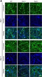 Rabbit IgG (H+L) Highly Cross-Adsorbed Secondary Antibody in Immunocytochemistry (ICC/IF)