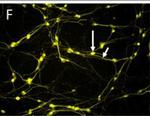 Rabbit IgG (H+L) Highly Cross-Adsorbed Secondary Antibody in Immunocytochemistry (ICC/IF)