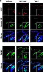 Rabbit IgG (H+L) Cross-Adsorbed Secondary Antibody in Immunohistochemistry (IHC)