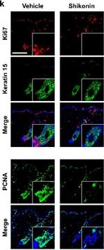 Rabbit IgG (H+L) Cross-Adsorbed Secondary Antibody in Immunohistochemistry (IHC)