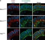 Mouse IgG (H+L) Cross-Adsorbed Secondary Antibody in Immunohistochemistry (IHC)