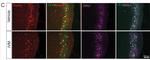 Rabbit IgG (H+L) Highly Cross-Adsorbed Secondary Antibody in Immunohistochemistry (IHC)