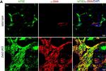 Mouse IgG2a Cross-Adsorbed Secondary Antibody in Immunohistochemistry (IHC)