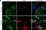 Mouse IgG2a Cross-Adsorbed Secondary Antibody in Immunohistochemistry (IHC)