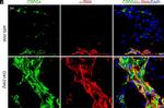 Mouse IgG2a Cross-Adsorbed Secondary Antibody in Immunohistochemistry (IHC)