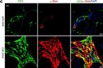 Mouse IgG2a Cross-Adsorbed Secondary Antibody in Immunohistochemistry (IHC)