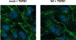 Rabbit IgG (H+L) Cross-Adsorbed Secondary Antibody in Immunocytochemistry (ICC/IF)