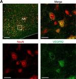 Mouse IgG (H+L) Highly Cross-Adsorbed Secondary Antibody in Immunohistochemistry (IHC)