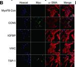 Rabbit IgG (H+L) Cross-Adsorbed Secondary Antibody in Immunocytochemistry (ICC/IF)