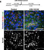 Rabbit IgG (H+L) Highly Cross-Adsorbed Secondary Antibody in Immunocytochemistry (ICC/IF)