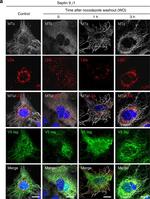 Mouse IgG (H+L) Highly Cross-Adsorbed Secondary Antibody in Immunocytochemistry (ICC/IF)