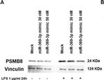 Rabbit IgG (H+L) Secondary Antibody in Western Blot (WB)