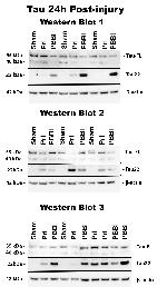 Tau (Cleaved Asp421, Asp422) Antibody in Western Blot (WB)