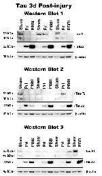 Tau (Cleaved Asp421, Asp422) Antibody in Western Blot (WB)