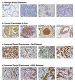 TNF alpha Antibody in Immunohistochemistry (IHC)