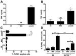 TNF alpha Antibody in ELISA (ELISA)