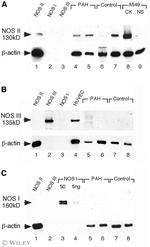 eNOS Antibody in Western Blot (WB)