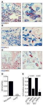 IRF4 Antibody in Immunohistochemistry (IHC)