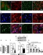 beta-2 Adrenergic Receptor Antibody in Western Blot (WB)