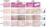 CD8a Antibody in Immunohistochemistry (IHC)