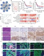 CD8a Antibody in Immunohistochemistry (IHC)