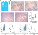 HYAL1 Antibody in Immunohistochemistry (IHC)