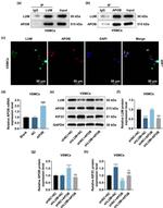 Apolipoprotein B Antibody in Western Blot (WB)