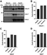 GALK1 Antibody in Western Blot (WB)