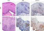 Eotaxin 3 Antibody in Immunohistochemistry (IHC)