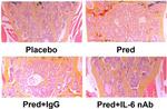 IL-6 Antibody in Neutralization (Neu)