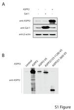 Galectin 1 Antibody in Western Blot (WB)