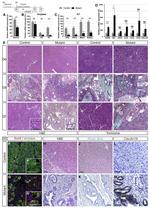 Claudin 18 Antibody in Immunohistochemistry (IHC)