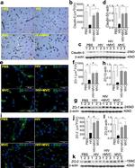 ZO-2 Antibody in Immunohistochemistry (IHC)