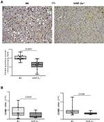 PCNA Antibody in Immunohistochemistry (IHC)