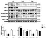 Tau Antibody in Western Blot (WB)