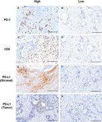 CD8 Antibody in Immunohistochemistry (IHC)