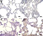 CD105 (Endoglin) Antibody in Immunohistochemistry (IHC)