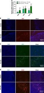 iNOS Antibody in Immunohistochemistry (IHC)