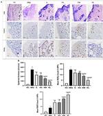 FOXP3 Antibody in Immunohistochemistry (IHC)