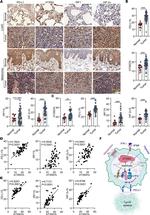 HIF-2 alpha Antibody in Immunohistochemistry (IHC)