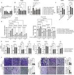 IL-6 Antibody in Neutralization (Neu)