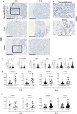 ZEB1 Antibody in Immunohistochemistry (IHC)