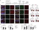 GFAP Antibody in Immunohistochemistry (IHC)