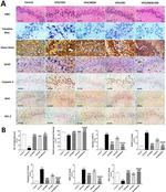 Bcl-2 Antibody in Immunohistochemistry (IHC)