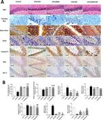 Bcl-2 Antibody in Immunohistochemistry (IHC)