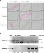 Annexin A3 Antibody in Western Blot (WB)