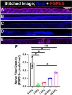 PGP9.5 Antibody in Immunohistochemistry (IHC)