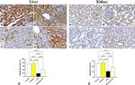 Bcl-2 Antibody in Immunohistochemistry (IHC)